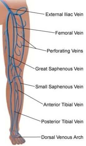 veins observe during thrombophlebitis.jpeg